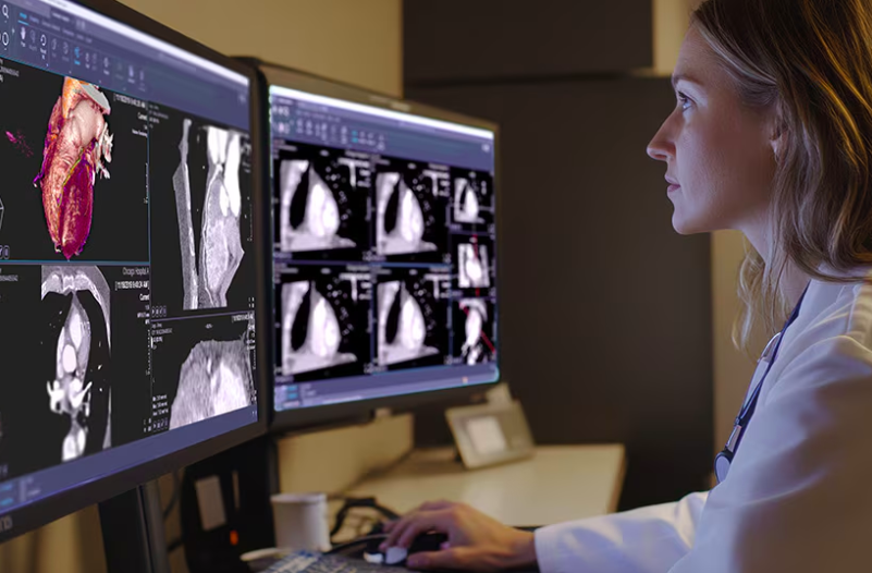 Les nouveautés de l’IRM cardiaque de Philips